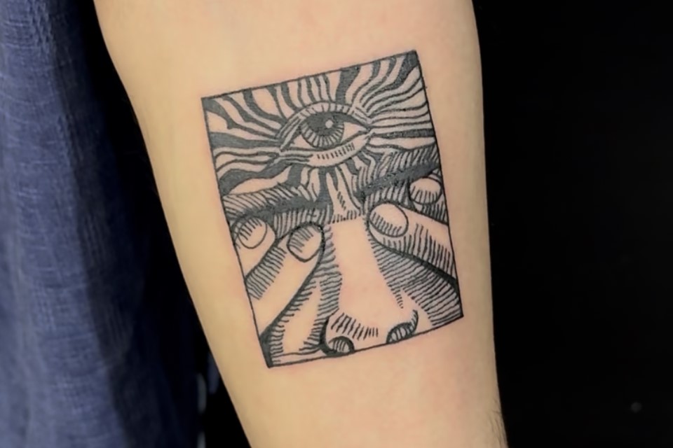 Laser tattoo removal – safe, effective treatment to fade unwanted tattoos