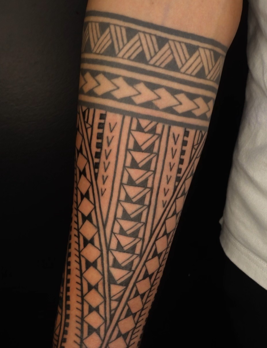 Laser tattoo removal near me – painless tattoo fading session at Surrey studio